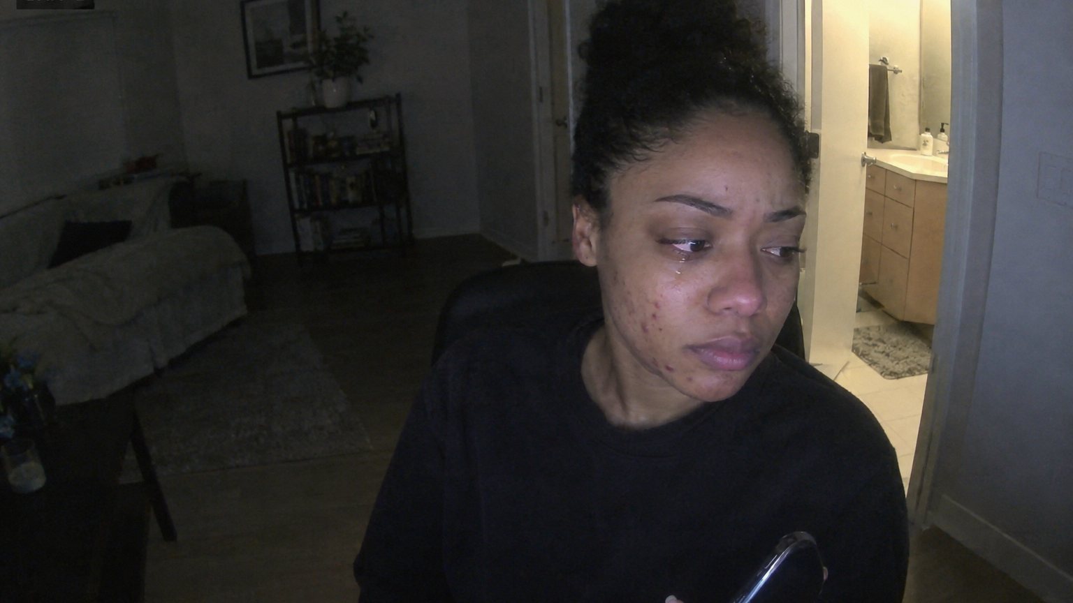 A worried adult woman sits at night with a phone selfie open, ordinary jawline acne visible in laptop webcam light.